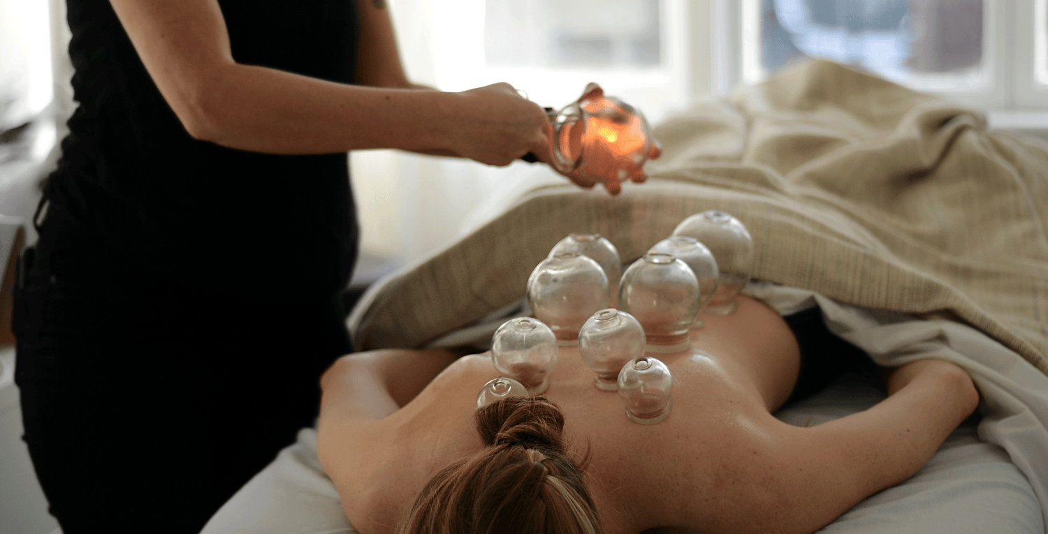 Cupping Therapy at SolSpa Kingston: Restore, Recover, Renew